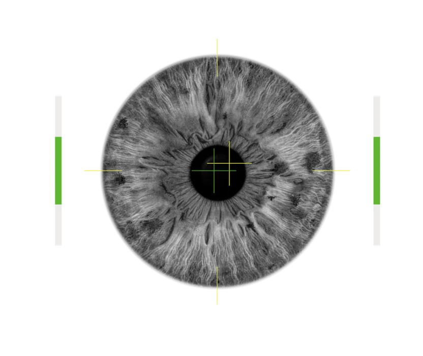 Eye-tracking illustration from Gangnam Smile Eye Clinic